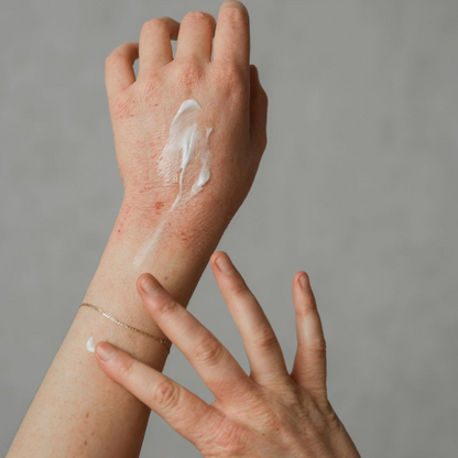 Overnight Eczema Relief Balm